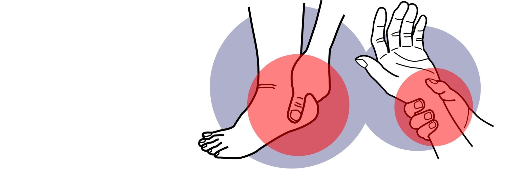 Symptome einer Polyneuropathie